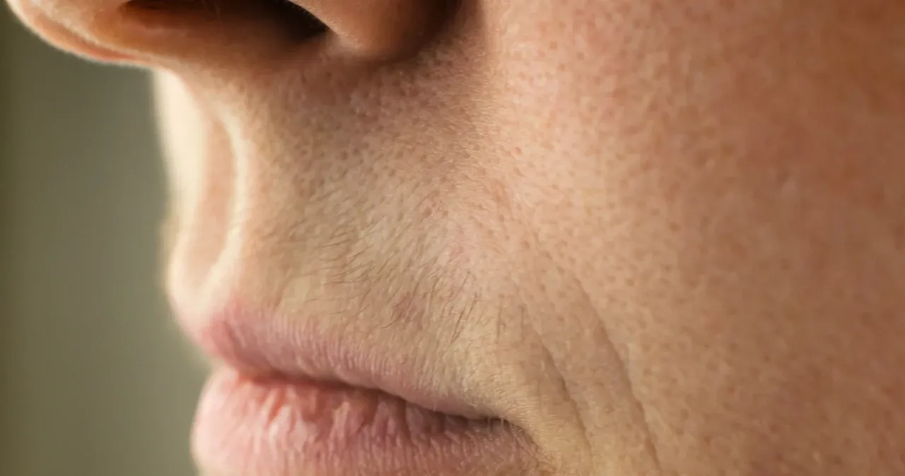 Jak usunąć wąsik żeby nie odrastał - skuteczne metody na zawsze