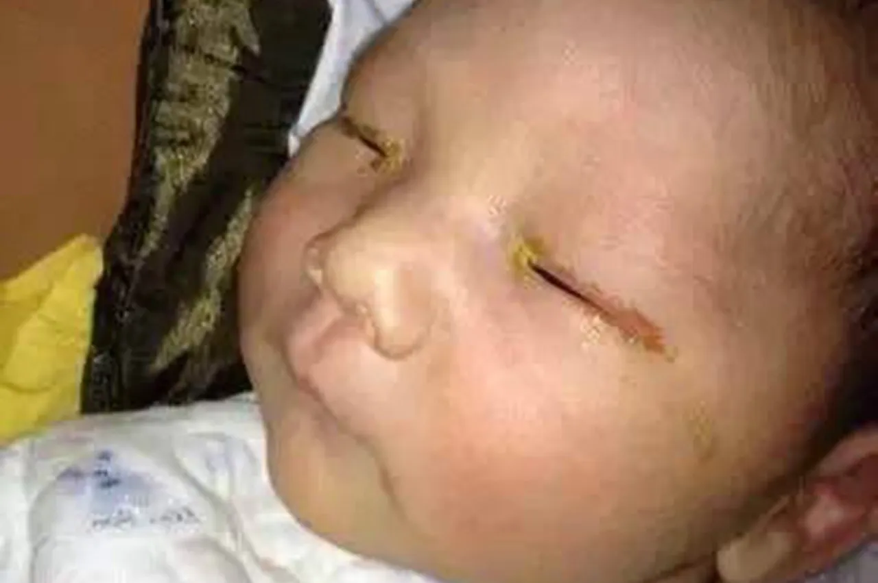 Lampa błyskowa a wzrok noworodka: Prawda o bezpieczeństwie fotografowania