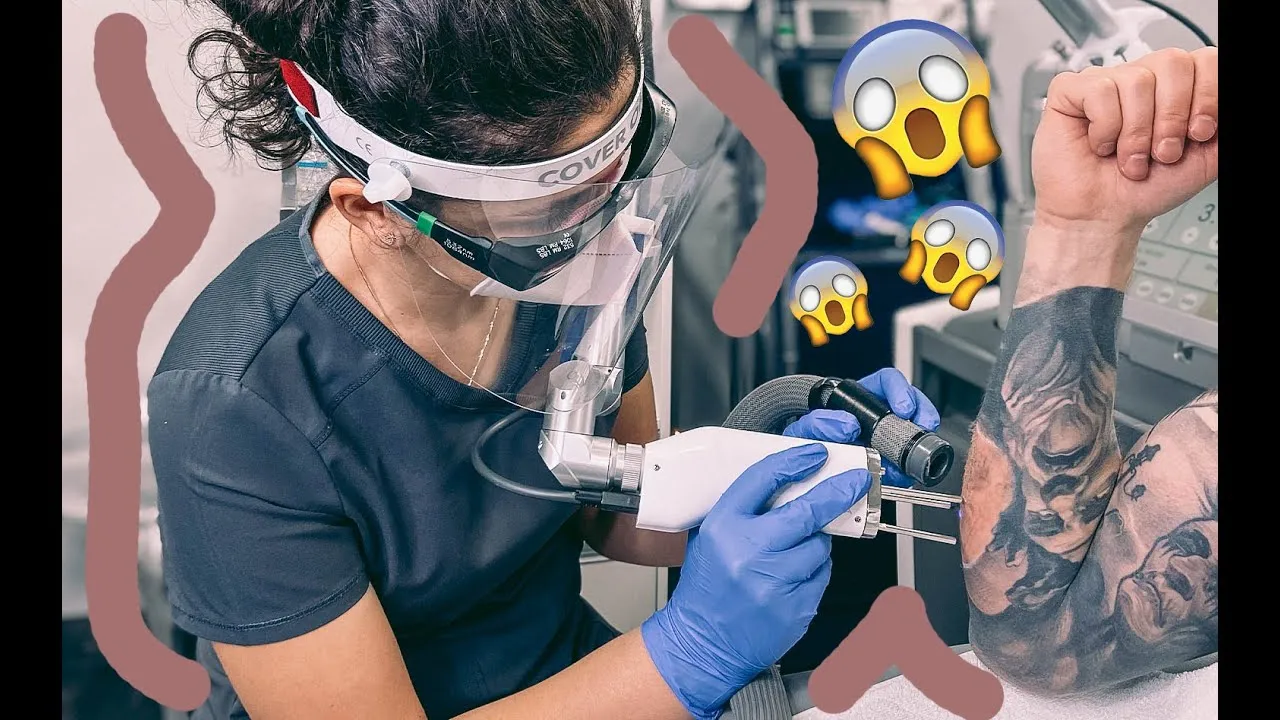 Jak wygląda usunięty tatuaż? Efekty i proces laserowego usuwania
