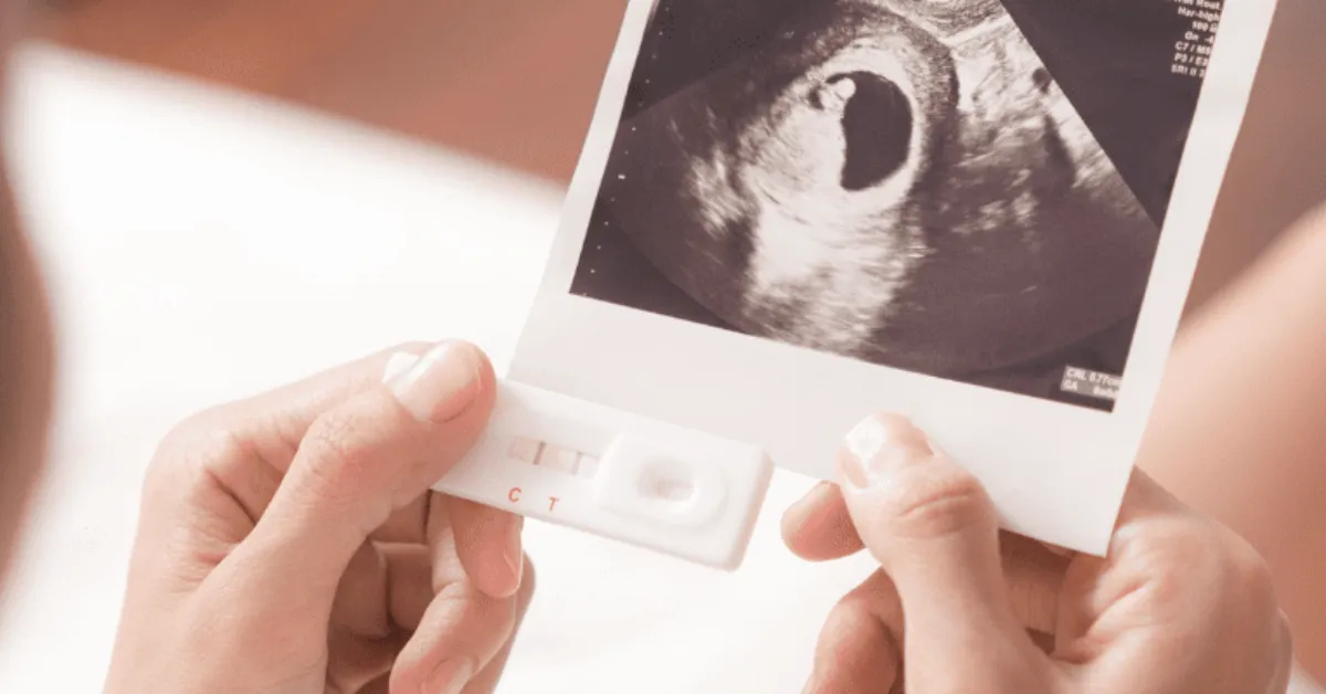 W którym tygodniu ciąży do ginekologa? Kluczowe informacje dla przyszłych mam