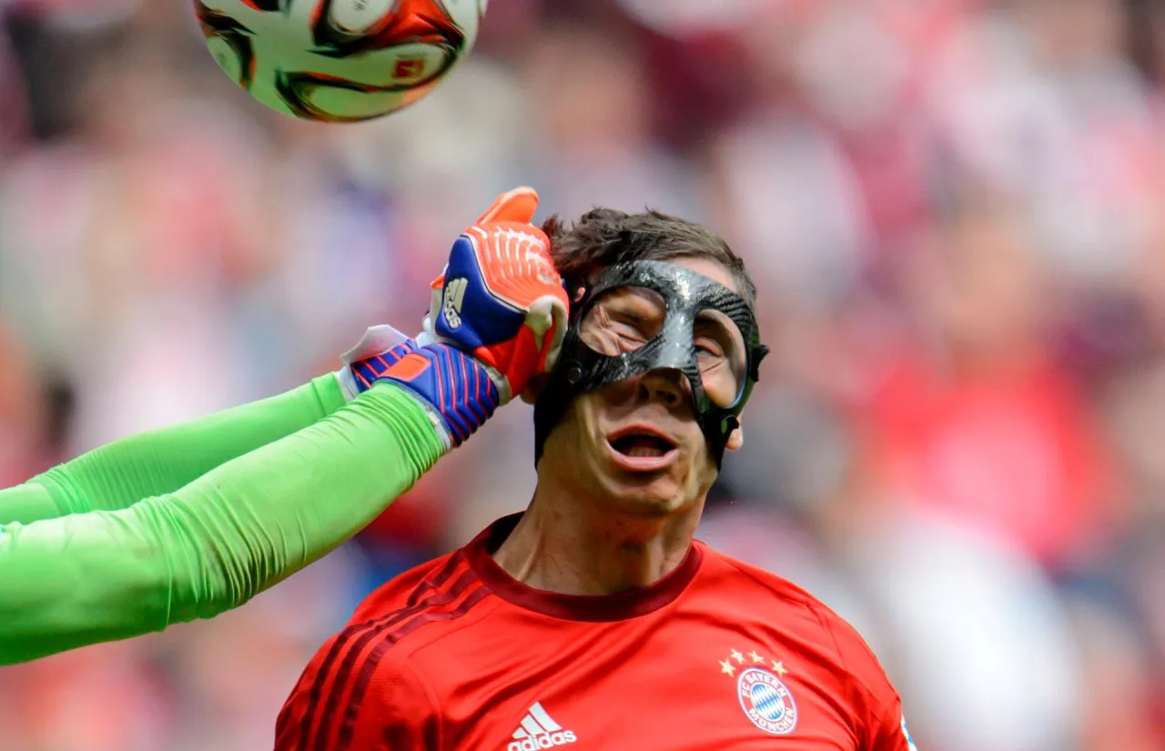 Dlaczego Lewandowski grał w masce? Szokująca prawda o kontuzji