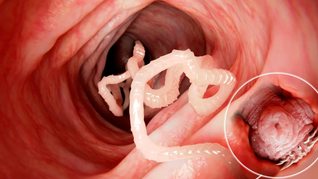 Pasożyty jelitowe - jakie badania wykonać w diagnostyce?